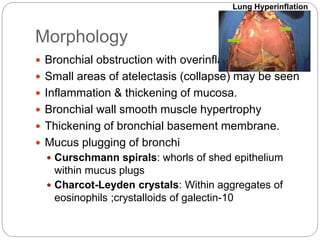 Morphology
 Bronchial obstruction with overinflation
 Small areas of atelectasis (collapse) may be seen
 Inflammation & thickening of mucosa.
 Bronchial wall smooth muscle hypertrophy
 Thickening of bronchial basement membrane.
 Mucus plugging of bronchi
 Curschmann spirals: whorls of shed epithelium
within mucus plugs
 Charcot-Leyden crystals: Within aggregates of
eosinophils ;crystalloids of galectin-10
Lung Hyperinflation
 