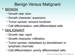 Benign Versus Malignant
• BENIGN
– Growth rate: slow
– Growth character: expansion
– Tumor spread: remains localized
– Cell differentiation: well-differentiated cells
• MALIGNANT
– Growth rate: rapid
– Growth character: infiltration
– Tumor spread: metastasis by bloodstream or
lymphatic channels
– Cell differentiation: poorly differentiated cells
 