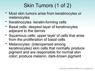 Skin Tumors (1 of 2)
• Most skin tumors arise from keratinocytes or
melanocytes
• Keratinocytes: keratin-forming cells
• Basal cells: deepest layer of keratinocytes
adjacent to the dermis
• Squamous cells: upper layer of cells that arise
from the proliferation of basal cells
• Melanocytes: (interspersed among
keratinocytes) skin cells that normally produce
pigment and are responsible for normal skin
color; produce melanin, dark-brown pigment
 