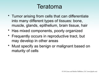 Teratoma
• Tumor arising from cells that can differentiate
into many different types of tissues: bone,
muscle, glands, epithelium, brain tissue, hair
• Has mixed components, poorly organized
• Frequently occurs in reproductive tract, but
may develop in other areas
• Must specify as benign or malignant based on
maturity of cells
 