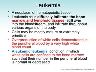 Leukemia
• A neoplasm of hematopoietic tissue
• Leukemic cells diffusely infiltrate the bone
marrow and lymphoid tissues, spill over
into the bloodstream, and infiltrate throughout
various organs of the body
• Cells may be mostly mature or extremely
primitive
• Overproduction of white cells demonstrated in
the peripheral blood by a very high white
blood count
• Aleukemic leukemia: condition in which
white cells are confined to the bone marrow
such that their number in the peripheral blood
is normal or decreased
 