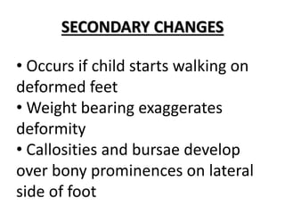 SECONDARY CHANGES
• Occurs if child starts walking on
deformed feet
• Weight bearing exaggerates
deformity
• Callosities and bursae develop
over bony prominences on lateral
side of foot
 
