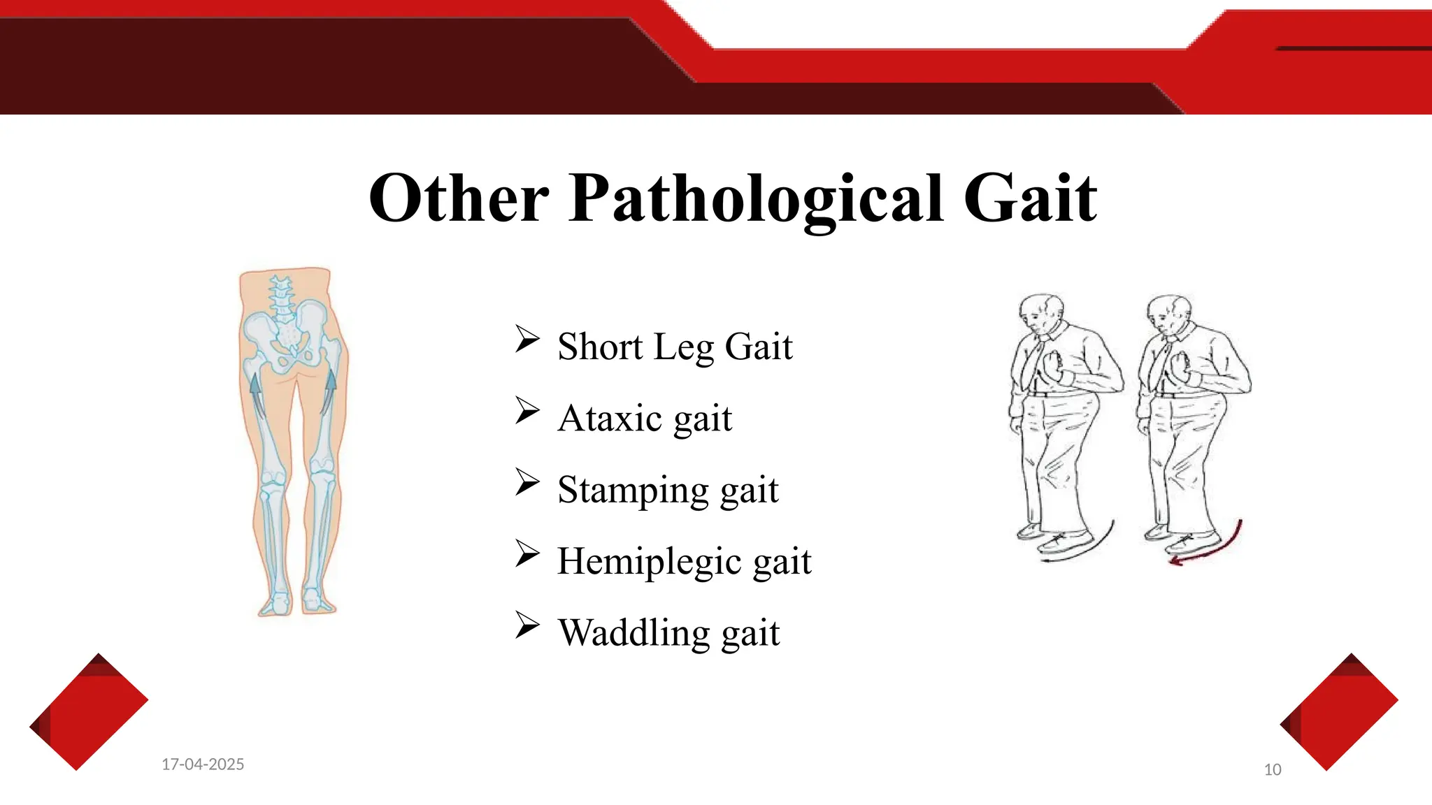 10
17-04-2025
Other Pathological Gait
 Short Leg Gait
 Ataxic gait
 Stamping gait
 Hemiplegic gait
 Waddling gait
 