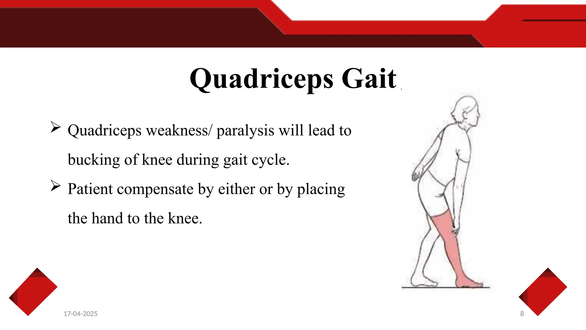 8
17-04-2025
Quadriceps Gait
 Quadriceps weakness/ paralysis will lead to
bucking of knee during gait cycle.
 Patient compensate by either or by placing
the hand to the knee.
 