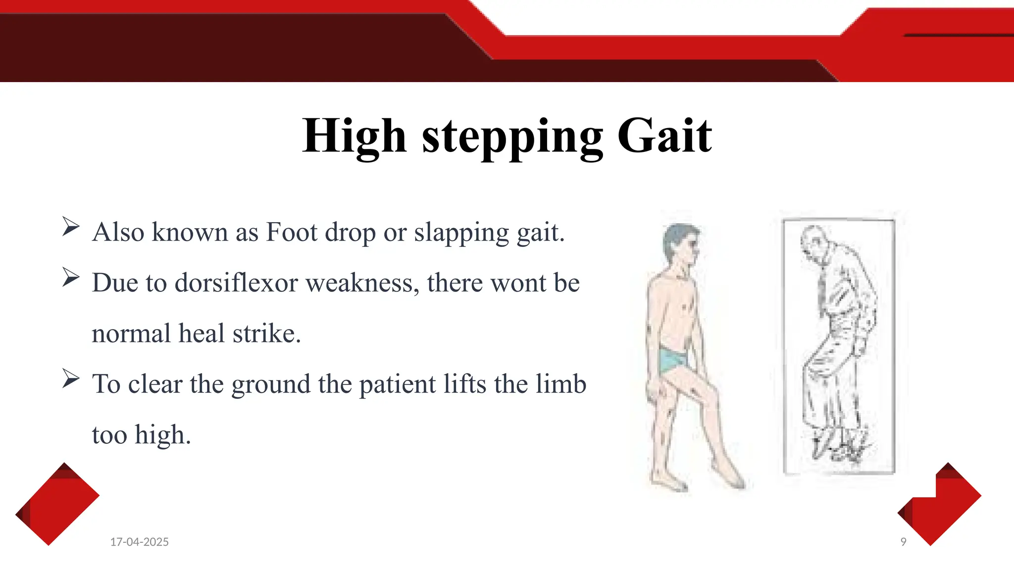 9
17-04-2025
High stepping Gait
 Also known as Foot drop or slapping gait.
 Due to dorsiflexor weakness, there wont be
normal heal strike.
 To clear the ground the patient lifts the limb
too high.
 