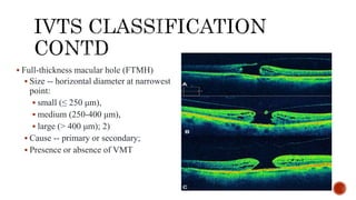 Pathogenesis and management of macular holes with video demonstration.pptx