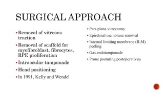 Pathogenesis and management of macular holes with video demonstration.pptx