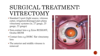 Pathogenesis and management of macular holes with video demonstration.pptx
