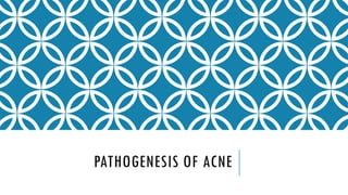 PATHOGENESIS OF ACNE VULGARIS- HORMONALS | PPTX