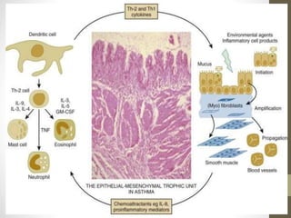 Pathogenesis of asthma | PPTX