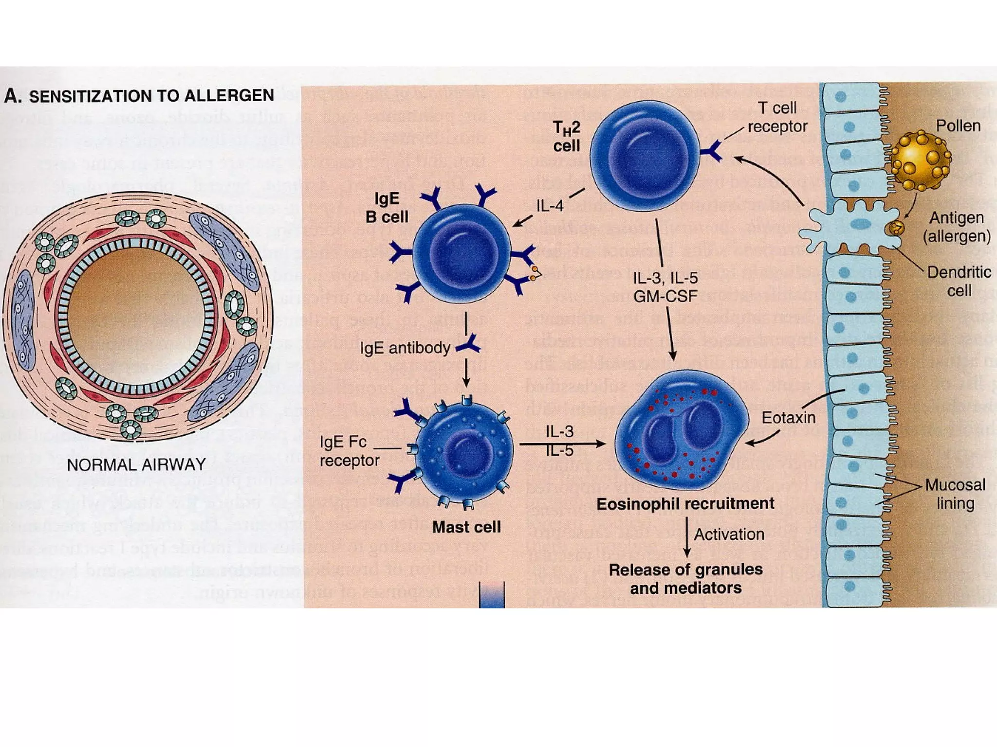 Pathogenesis of bronchial asthma | PPT