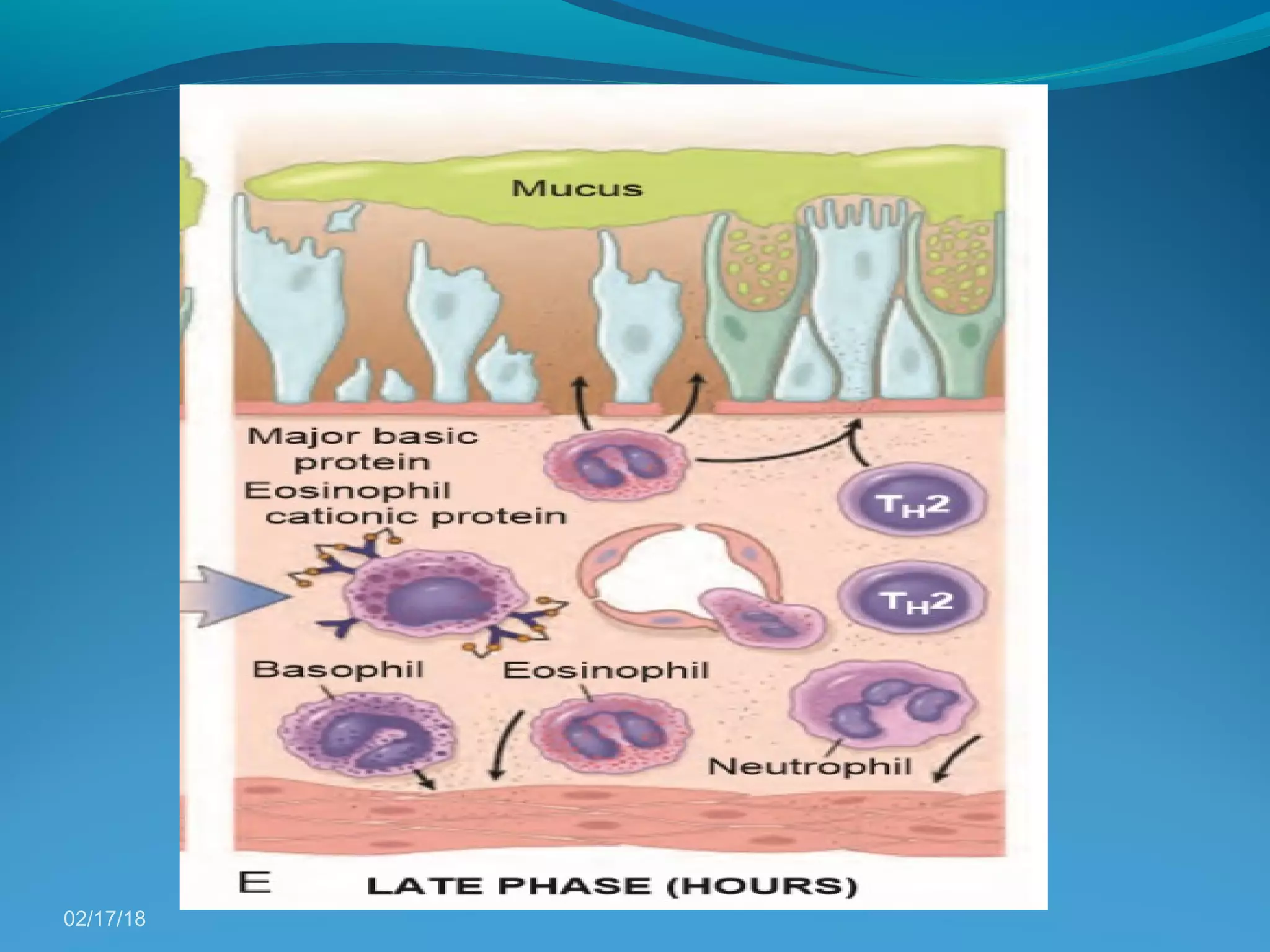 Pathogenesis of bronchial asthma | PPT