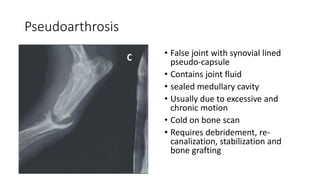 Pseudoarthrosis
• False joint with synovial lined
pseudo-capsule
• Contains joint fluid
• sealed medullary cavity
• Usually due to excessive and
chronic motion
• Cold on bone scan
• Requires debridement, re-
canalization, stabilization and
bone grafting
 