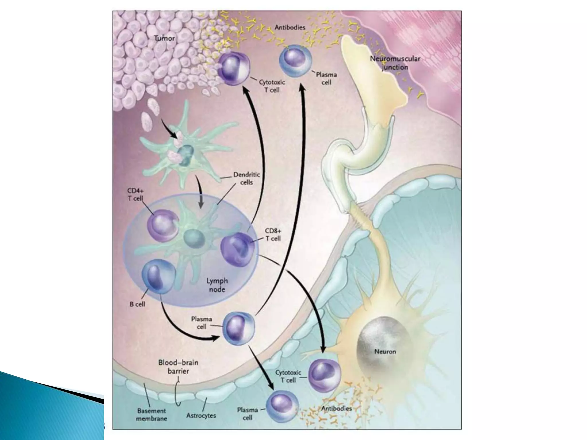 Pathogenesis of Paraneoplastic Syndromes.pptx