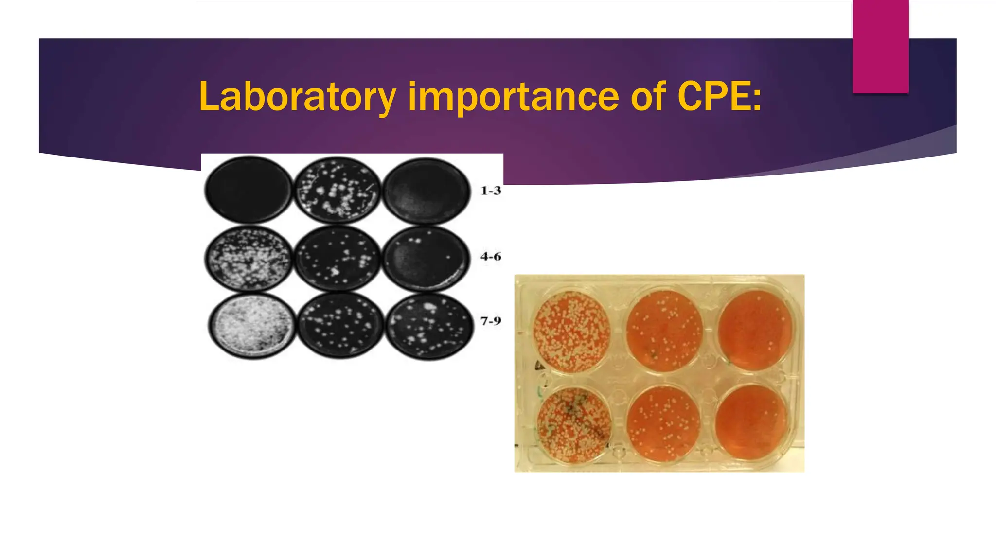 Laboratory importance of CPE:
1
2
 
