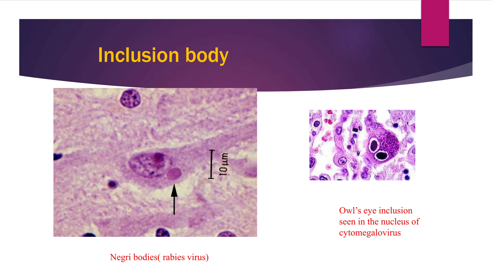 Inclusion body
8
Owl’s eye inclusion
seen in the nucleus of
cytomegalovirus
Negri bodies( rabies virus)
 