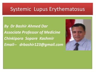 Systemic  Lupus Erythematosus By  Dr Bashir Ahmed Dar Associate Professor of Medicine Chinkipora  Sopore  Kashmir Email--   drbashir123@gmail.com 