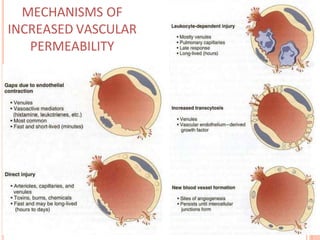 MECHANISMS OF
INCREASED VASCULAR
PERMEABILITY
 