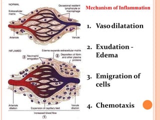 Mechanism of Inflammation
1. Vasodilatation
2. Exudation ‐
Edema
3. Emigration of
cells
4. Chemotaxis
 