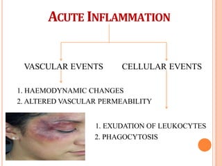 ACUTE INFLAMMATION
VASCULAR EVENTS CELLULAR EVENTS
1. HAEMODYNAMIC CHANGES
2. ALTERED VASCULAR PERMEABILITY
1. EXUDATION OF LEUKOCYTES
2. PHAGOCYTOSIS
 
