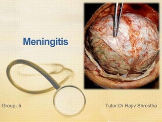 Meningitis
Group- 5 Tutor:Dr.Rajiv Shrestha
 