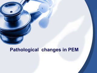 Pathological changes in PEM
 
