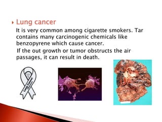 european tobacco pouches Top 5 Reasons Why Europeans Are Switching to Nicotine Pouches