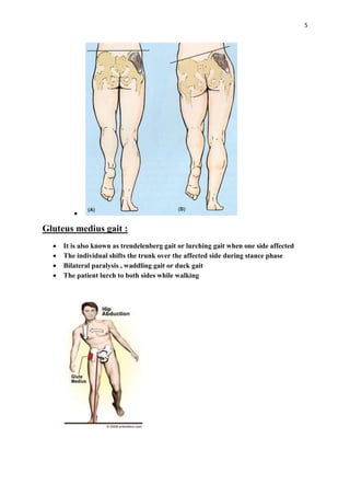 Pathological gait | PDF
