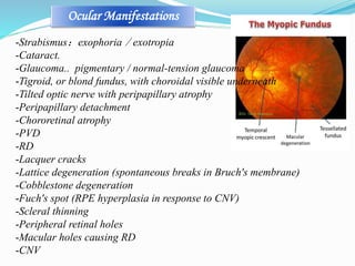 Ocular Manifestations 
-Strabismus：exophoria／exotropia 
-Cataract. 
-Glaucoma.. pigmentary / normal-tension glaucoma 
-Tigroid, or blond fundus, with choroidal visible underneath 
-Tilted optic nerve with peripapillary atrophy 
-Peripapillary detachment 
-Chororetinal atrophy 
-PVD 
-RD 
-Lacquer cracks 
-Lattice degeneration (spontaneous breaks in Bruch's membrane) 
-Cobblestone degeneration 
-Fuch's spot (RPE hyperplasia in response to CNV) 
-Scleral thinning 
-Peripheral retinal holes 
-Macular holes causing RD 
-CNV 
 