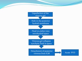 Liquefaction of the 
vitreous gel 
Hole in the posterior 
hyaloid membrane 
Fluid tru defect into 
retrohyaloid space 
Vitreous gel collapses 
synchytic fluid in space 
Detachment of posterior 
vitreous from ILM Acute PVD 
 