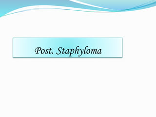 Post. Staphyloma 
 