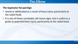 Supinator Sign Pathological significance of soft tissue and fat planes | PPTX