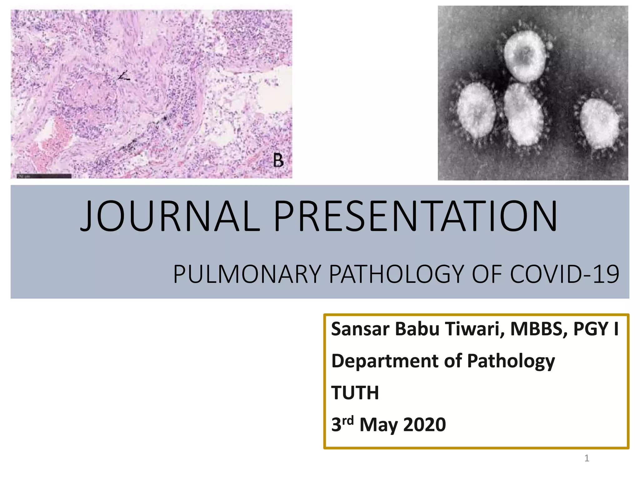 Pulmonary pathology of corona virus | PPTX