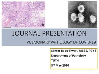 JOURNAL PRESENTATION
PULMONARY PATHOLOGY OF COVID-19
Sansar Babu Tiwari, MBBS, PGY I
Department of Pathology
TUTH
3rd May 2020
1
 
