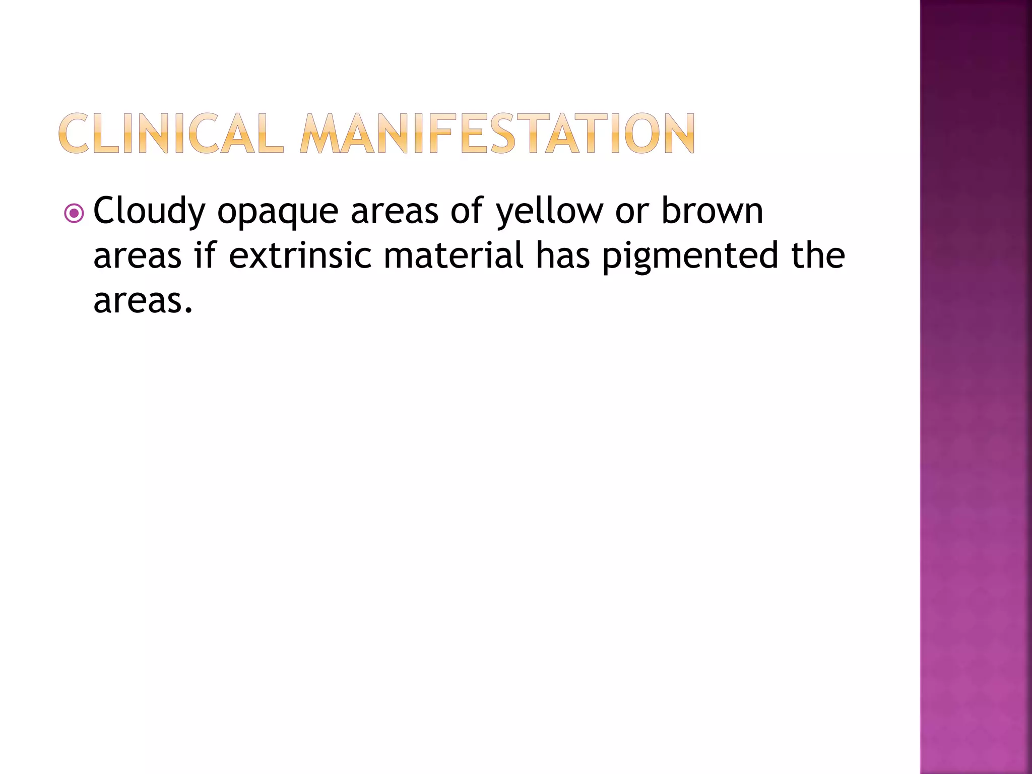  Cloudy opaque areas of yellow or brown 
areas if extrinsic material has pigmented the 
areas. 
 