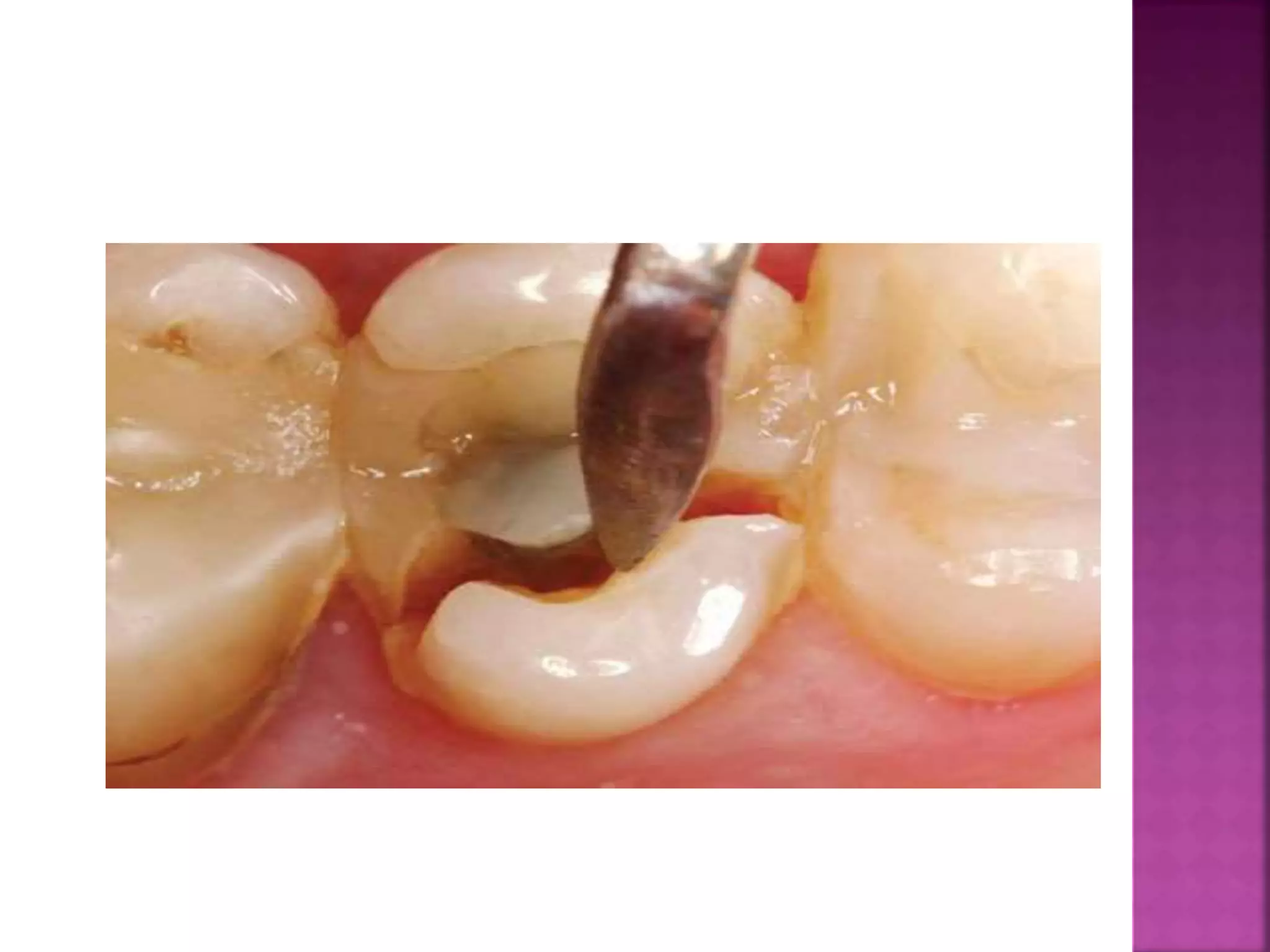 Pathologic conditions affecting developmental disturbances and anomalies