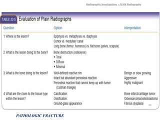 Radiographic Investigations – PLAIN Radiography
PATHOLOGIC FRACTURE
20
 