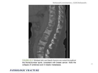 Radiographic Investigations – PLAIN Radiography
PATHOLOGIC FRACTURE
23
 