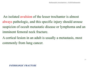 An isolated avulsion of the lesser trochanter is almost
always pathologic, and this specific injury should arouse
suspicion of occult metastatic disease or lymphoma and an
imminent femoral neck fracture.
A cortical lesion in an adult is usually a metastasis, most
commonly from lung cancer.
Radiographic Investigations – PLAIN Radiography
PATHOLOGIC FRACTURE
24
 