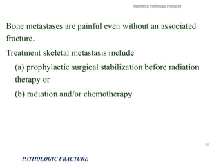 Bone metastases are painful even without an associated
fracture.
Treatment skeletal metastasis include
(a) prophylactic surgical stabilization before radiation
therapy or
(b) radiation and/or chemotherapy
Impending Pathologic Fractures
PATHOLOGIC FRACTURE
30
 