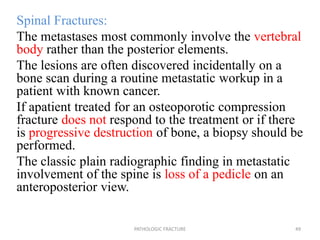 Spinal Fractures:
The metastases most commonly involve the vertebral
body rather than the posterior elements.
The lesions are often discovered incidentally on a
bone scan during a routine metastatic workup in a
patient with known cancer.
If apatient treated for an osteoporotic compression
fracture does not respond to the treatment or if there
is progressive destruction of bone, a biopsy should be
performed.
The classic plain radiographic finding in metastatic
involvement of the spine is loss of a pedicle on an
anteroposterior view.
PATHOLOGIC FRACTURE 49
 