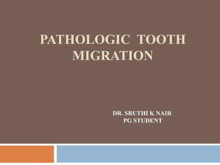 PATHOLOGIC TOOTH
MIGRATION
DR. SRUTHI K NAIR
PG STUDENT
 