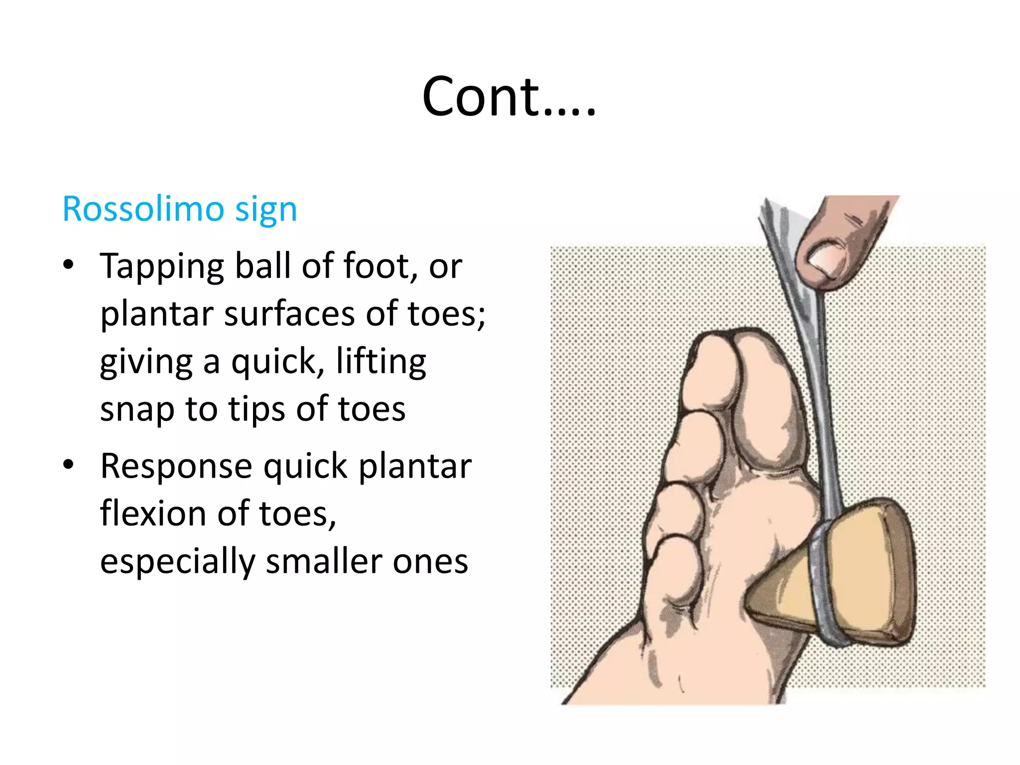 Pathologic Sign Pathologic Reflexes, Monofilament Tests & Meningeal Signs.pptx