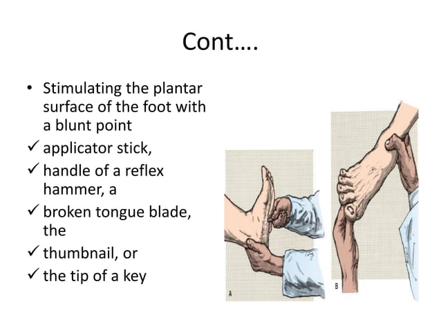 Pathologic Reflexes, Monofilament Tests & Meningeal Signs.pptx | Death ...