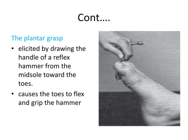 Pathologic Reflexes, Monofilament Tests & Meningeal Signs.pptx | Death ...