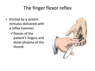 Hummer For Rflexes Pathologic Reflexes, Monofilament Tests & Meningeal Signs.pptx