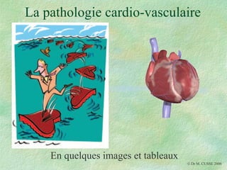 La pathologie cardio-vasculaire En quelques images et tableaux    Dr M. CUSSE 2006 