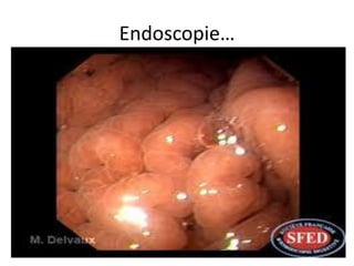 Endoscopie…
 