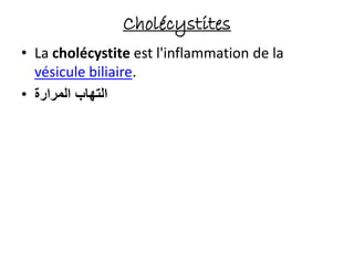 Cholécystites
• La cholécystite est l'inflammation de la
vésicule biliaire.
• ‫المرارة‬ ‫التهاب‬
 