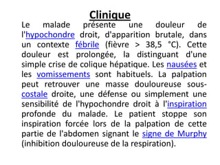 Clinique
Le malade présente une douleur de
l'hypochondre droit, d'apparition brutale, dans
un contexte fébrile (fièvre > 38,5 °C). Cette
douleur est prolongée, la distinguant d'une
simple crise de colique hépatique. Les nausées et
les vomissements sont habituels. La palpation
peut retrouver une masse douloureuse sous-
costale droite, une défense ou simplement une
sensibilité de l'hypochondre droit à l'inspiration
profonde du malade. Le patient stoppe son
inspiration forcée lors de la palpation de cette
partie de l'abdomen signant le signe de Murphy
(inhibition douloureuse de la respiration).
 